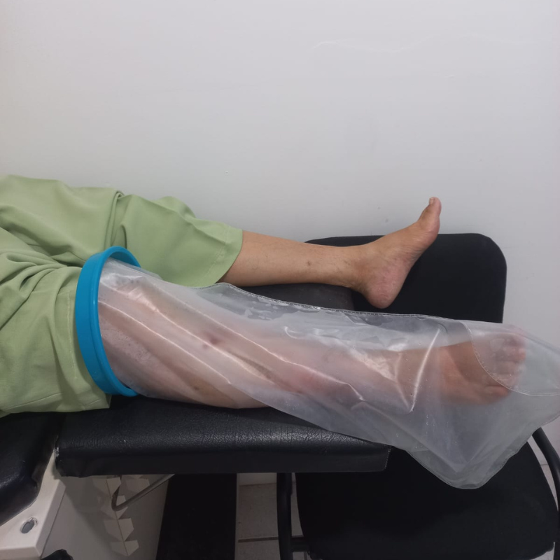 Medico para tratamiento de ulceras varicosas en piernas Queretaro